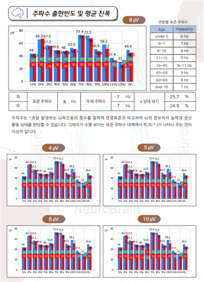 뇌파 검사 분석 결과지 인포그래픽